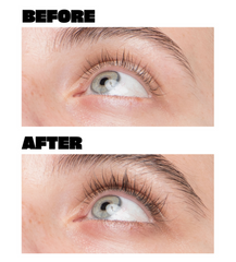 Close-up images of an eye illustrate the