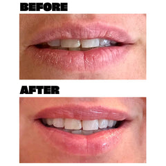 Babe Original Lip Mask (11g) - Model Shot Before & After