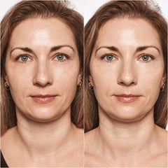 Catrice Cosmetics Liquid Camouflage High Coverage Concealer (5ml) - Model Shot 1 (Before & After) [010 Porcelain]