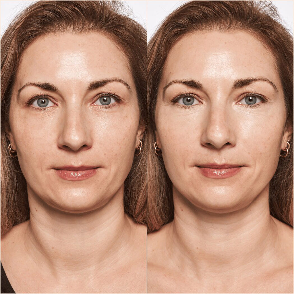 Catrice Cosmetics True Skin High Cover Concealer (4.5ml) - Model Shot 1 (Before & After) [002 Neutral Ivory]