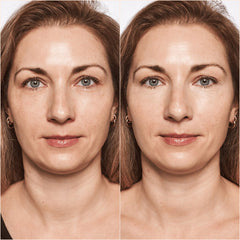 Catrice Cosmetics True Skin High Cover Concealer (4.5ml) - Model Shot 1 (Before & After) [002 Neutral Ivory]