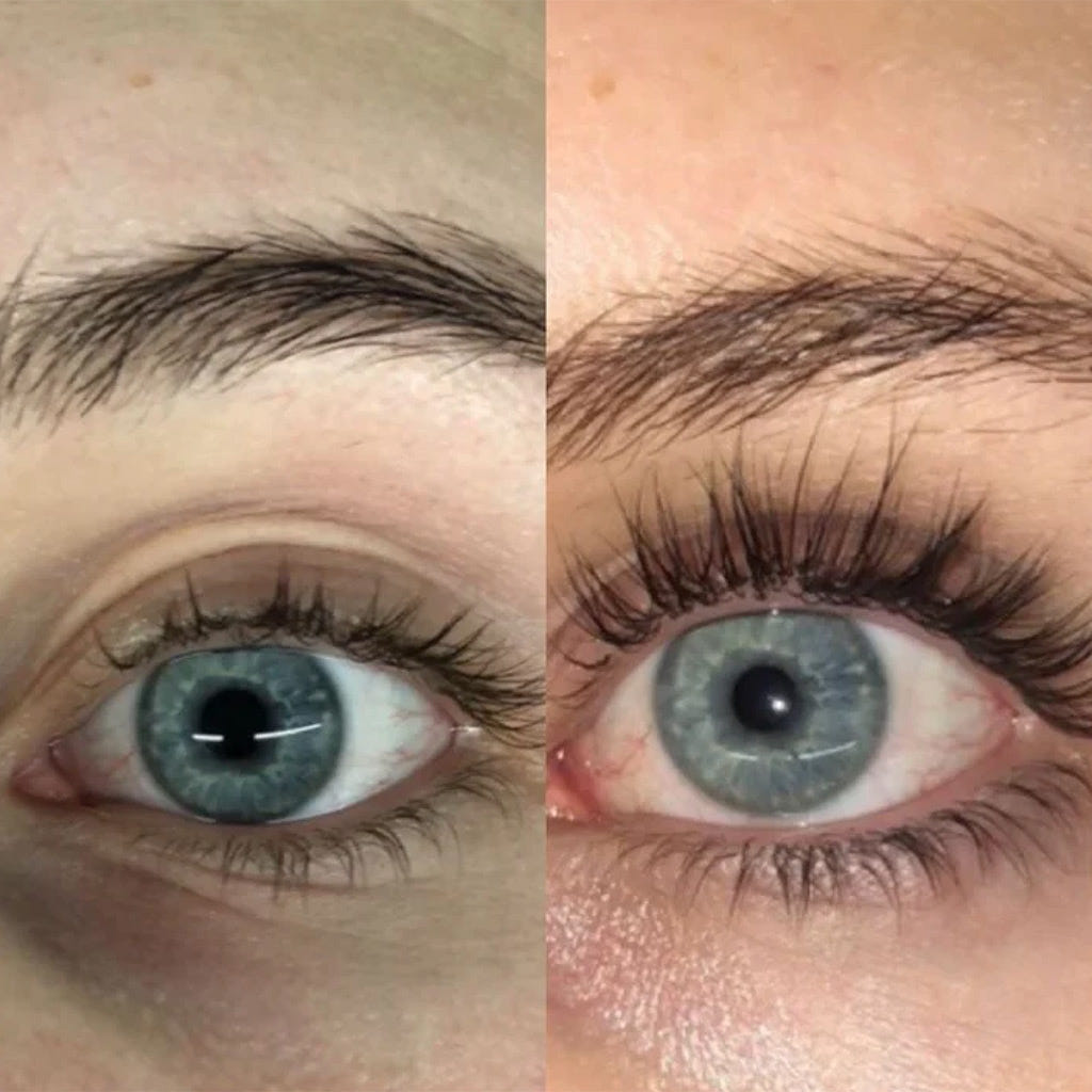 RapidLash Eyelash Enhancing Serum (Model Shot - Before and After)