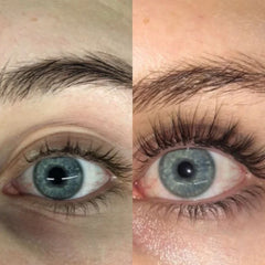 RapidLash Eyelash Enhancing Serum (Model Shot - Before and After)