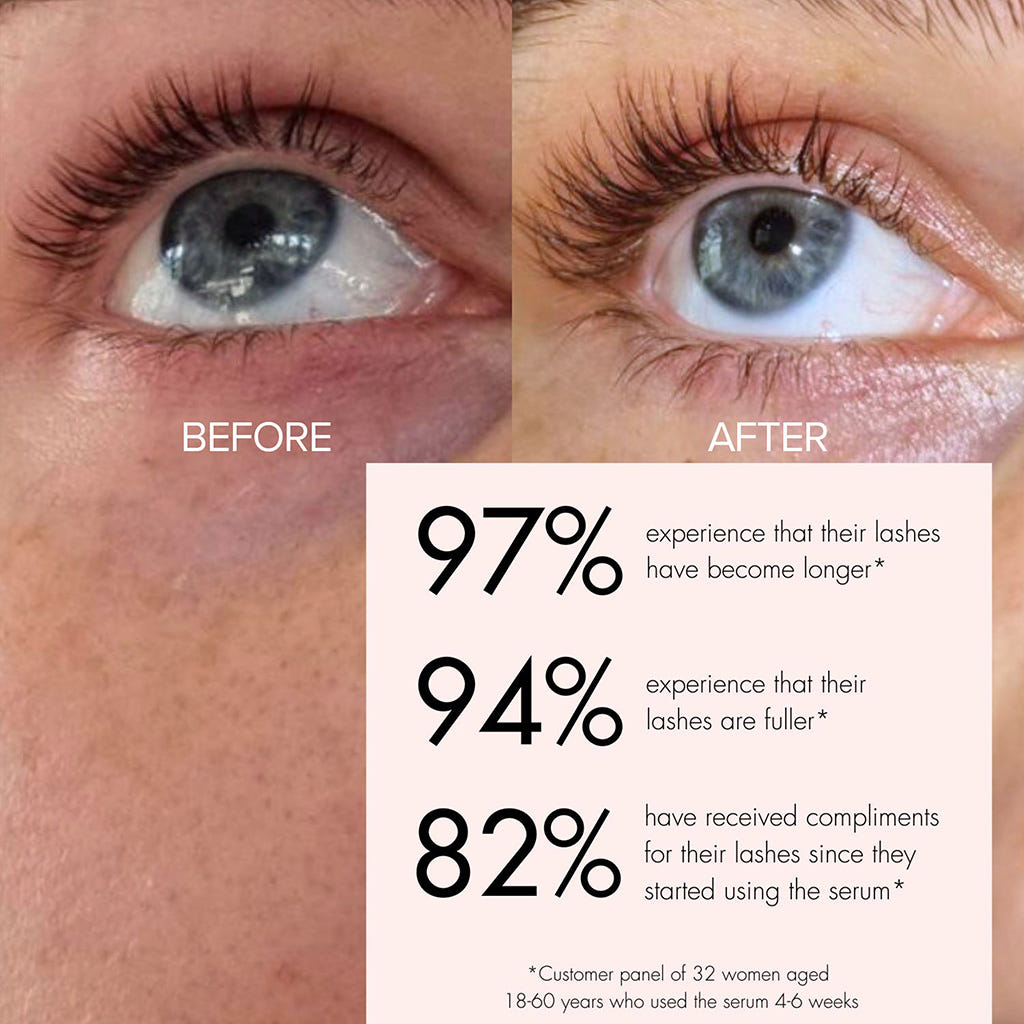 SWEED Pro Eyelash Growth Serum (Before and After Shot 1)