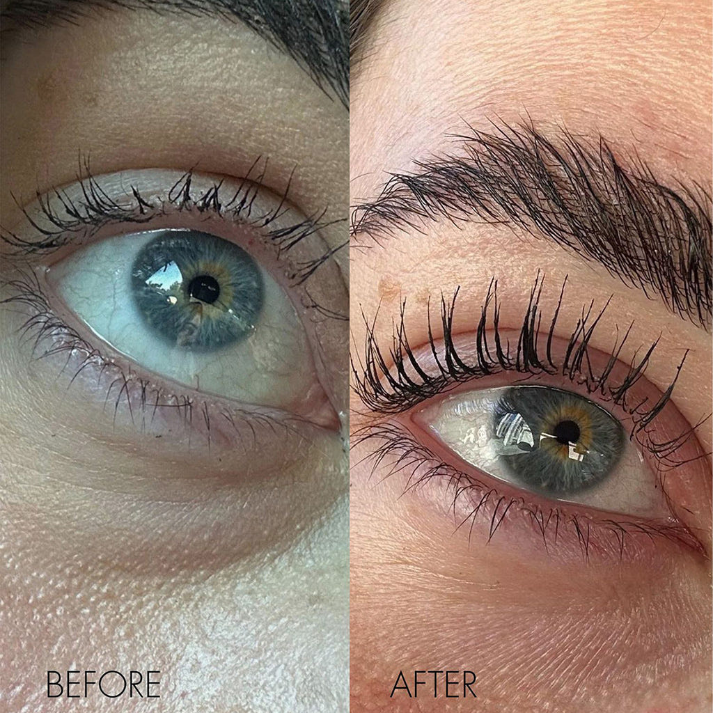 SWEED Pro Eyelash Growth Serum (Before and After Shot 2)