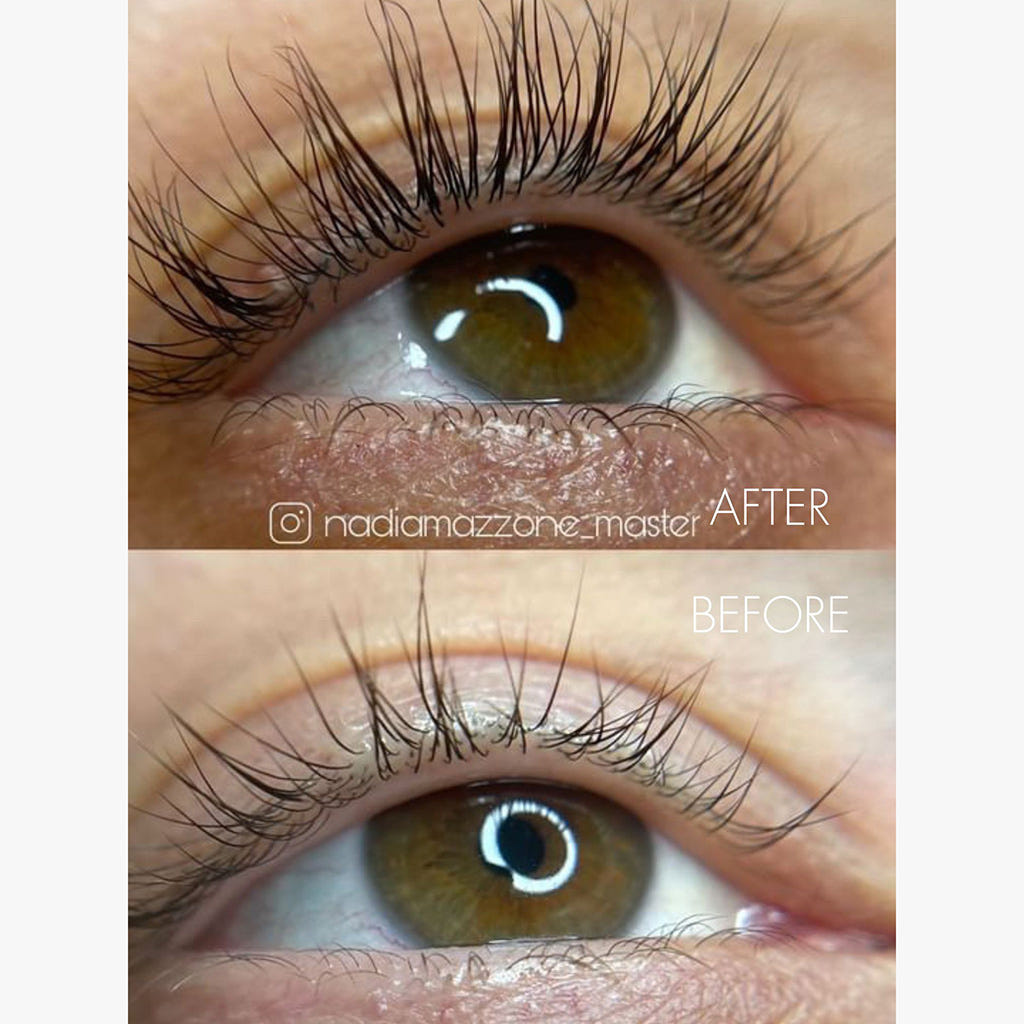 SWEED Pro Eyelash Growth Serum (Before and After Shot 3)