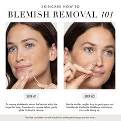 Tweezerman Whitehead and Blackhead Remover (formerly Skincare Tool) - Info 1